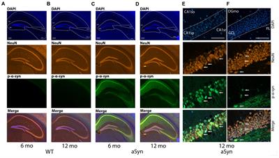 Alpha-Synuclein Pathology Coincides With Increased Number of Early Stage Neural Progenitors in the Adult Hippocampus